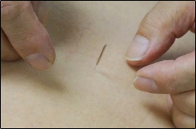 鍼灸マッサージ師さんの技「経穴をさわって感じ方をききます」